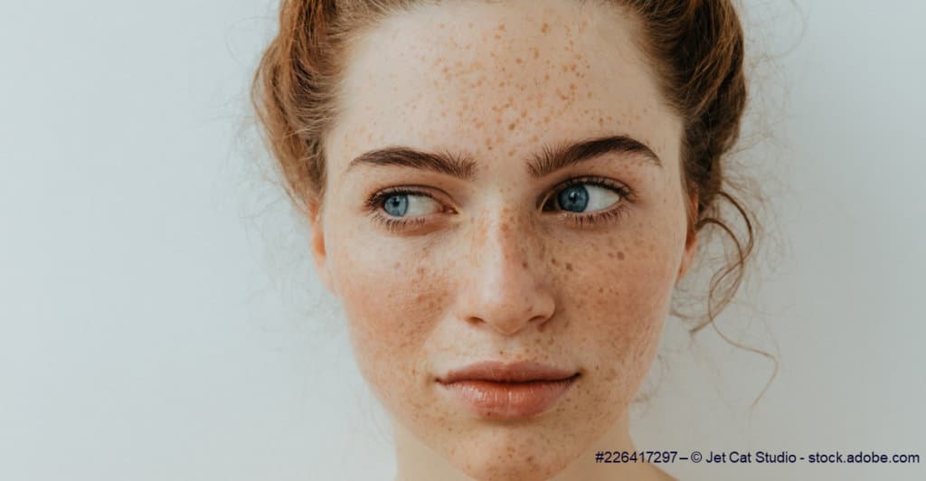 good skin corner